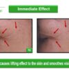 Active Lifting Cream 6 in 1 Light - Aktiivselt pinguldav kerge kreem - Image 3