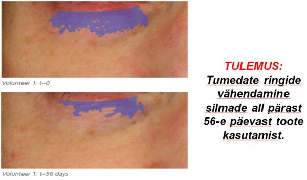 Golden Eye Cream - Kuldne silmakreem - Image 3