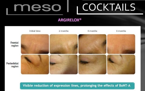 Botox Like Meso Coctail - Botox mesokokteil - Image 2
