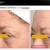 Collagen Meso Coctail - Kollageeni mesokokteil - Image 2