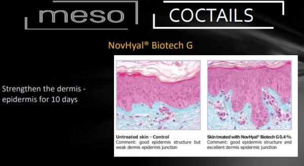 Hydra Meso Coctail - Niisutav mesokokteil - Image 2